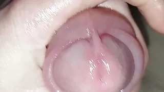 Penis pun o after one hour