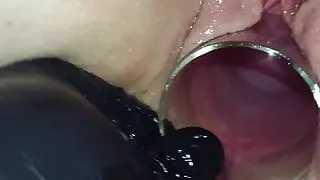 Gape 2