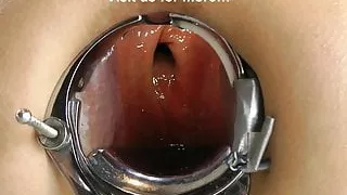 Incredible deep anal view XO speculum & light in Hotkinkyjo