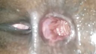 Gaped Jamaican Asshole PT.8