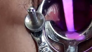 Advanced cervix play