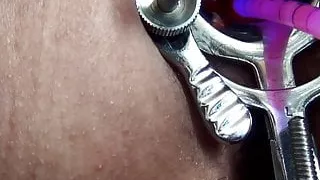 Advanced cervix play