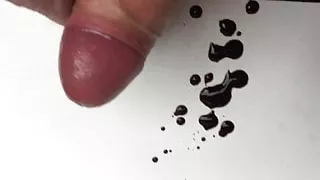 Schwuler Sex, Prostata