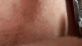 More cervix insertions