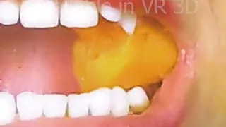 Kauen und Schlucken Kauen und Schlucken Vore Nahrung Kauzahn