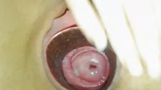 Woman showing her gaping pussy and cervix