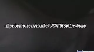 My bruised veiny legs