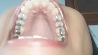 Sexy Latina Girl with Mouth Full of Fillings