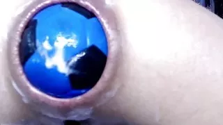 Hotkinkyjo tons of balls in destroyed anal hole & prolapse