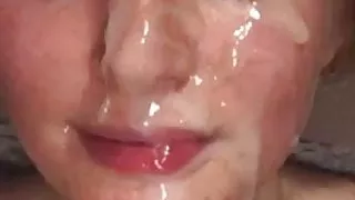 Scottishdream complication