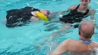 thalidomide mature lady