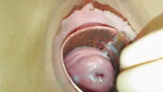 Hot Cervix Close Up Show On Webcam - CoViD-88