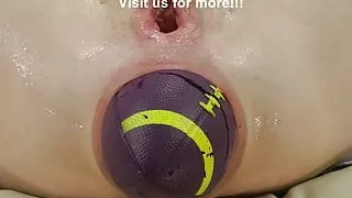 Big balls in Dirtygardengirl holes and prolapse
