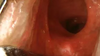 XO speculum and extreme deep anal dildo by Hotkinkyjo