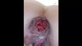 Gaping urethra