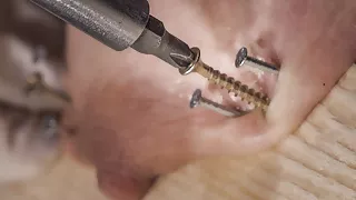 Screwdrivers - Queensnake.com - Queensect.com