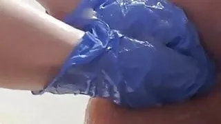 Moitsex elle me dilate le fion