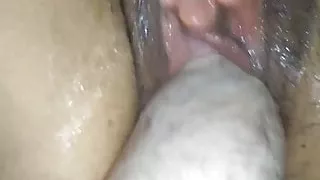 Extreme Prolapsed Milf Faustfick