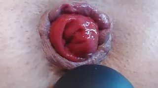 Anal play and prolapse play HD