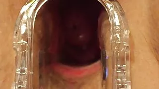 Wife speculum in pussy cervix 3