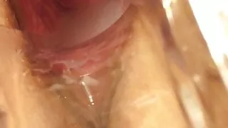 Wife speculum in pussy cervix 5