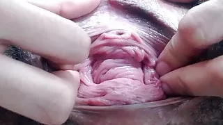 Pervert Files: 18yo Prolapsed Hairy Cunt Meat