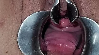 Speculum opening her peehole