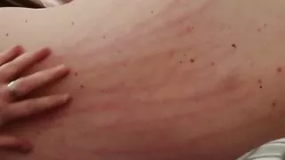 Well, you like scratching your back, too