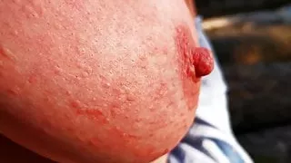 Nettle Punishment Day - Ass, tits and vagina in public - DC