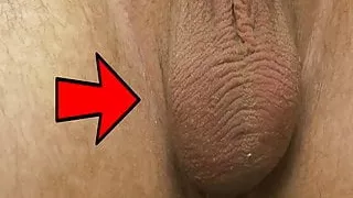 why do balls do this?