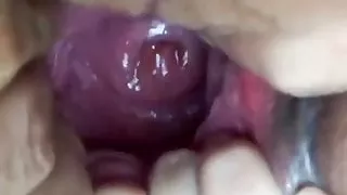 Pussy gape asian