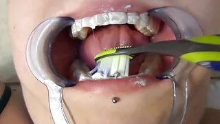 Dentist Probes Naughty Girl's Mouth