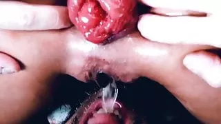 Anal Prolapse Piss Drinking Hubby