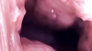 Stretched Open Pussy Walls Compilation