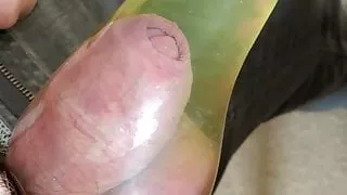 Amatør, Kondom, Homo