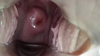 What's inside the pussy. CLOSE-UP OF THE UTERUS!