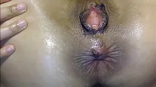 Butthole throbbing