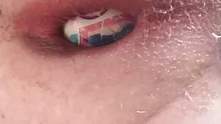 Smilis bol in anal 3