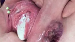 NASTY ANAL SLUTS COMPILATION – GAPED ASSHOLE PROLAPSED