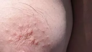 Hairy wife on nudist beach