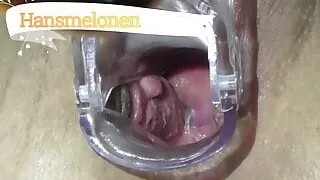 Gyno and Cervical Play