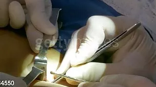 AJ Lee gains a third breast!