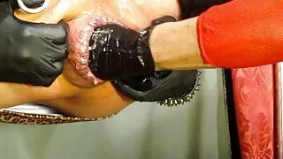 Anal fisting – huge crossdresser cunt