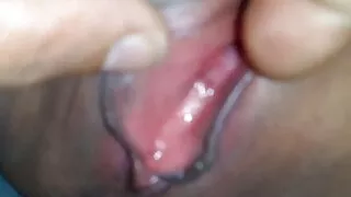 Vaginal