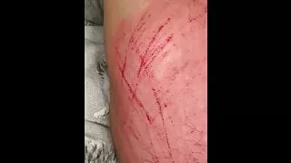 Back scratch Part 2 long natural nails