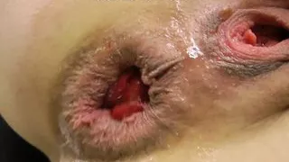 Sindy Rose fucks her ass with a big white dong & prolapse