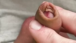 small dick forskin play