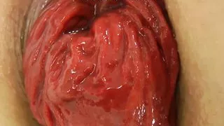 Sindy Rose take big anal dong in her butt & anal prolapse