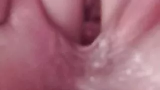 Der arsch braucht es