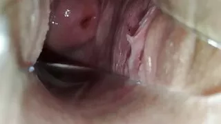 At the GYNECOLOGIST!! A speculum in the girl's pussy!!